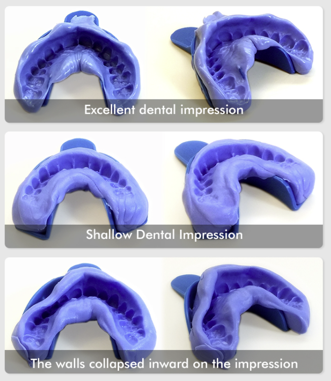 Dental Impression Kit With Putty For Teeth Whitening Grinder Guard and Aligner